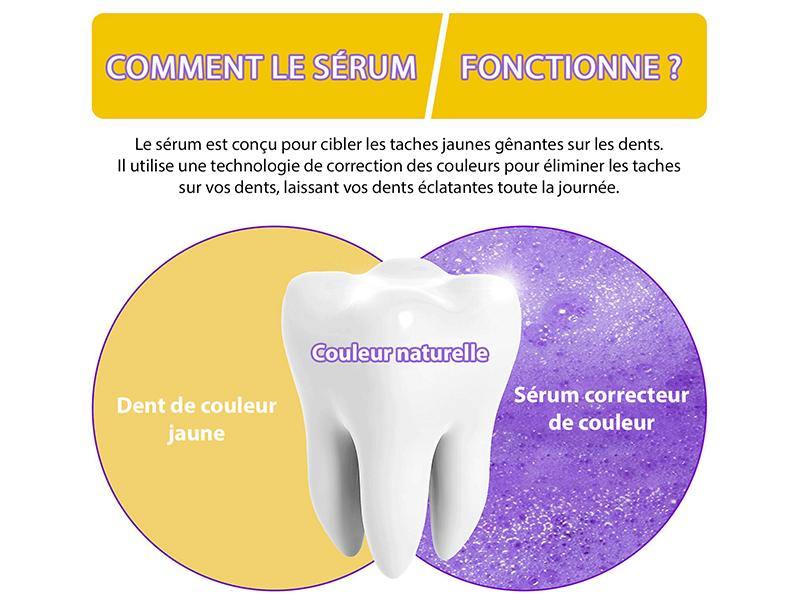 Gamme Violette - Blanchiment des Dents par la Science des Couleurs