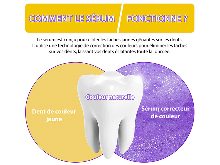 Gamme Violette - Blanchiment des Dents par la Science des Couleurs